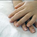 arthritic-hands